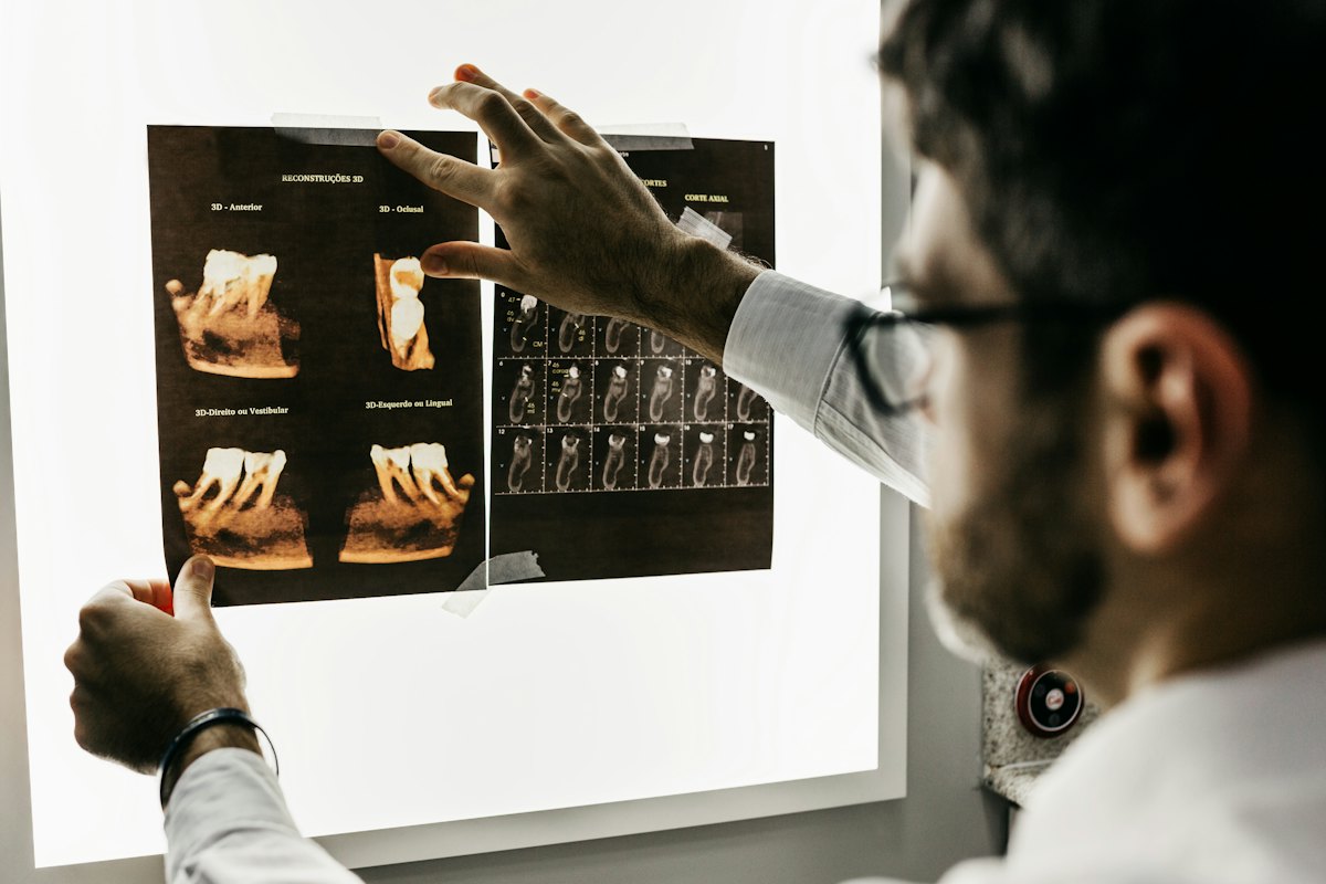 Dentist reviewing dental X-ray films on a light board